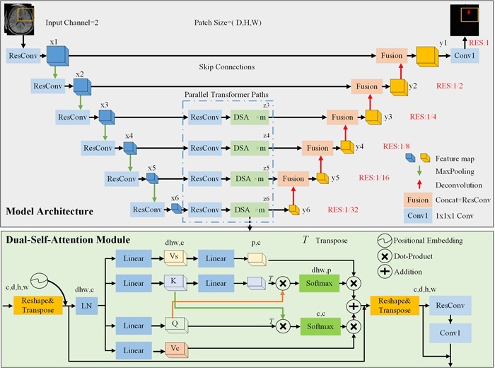 Image: Multiscale transformer based FCD lesion segmentation framework (Photo courtesy of SIAT/doi.org/10.1186/s13244-024-01803-8)